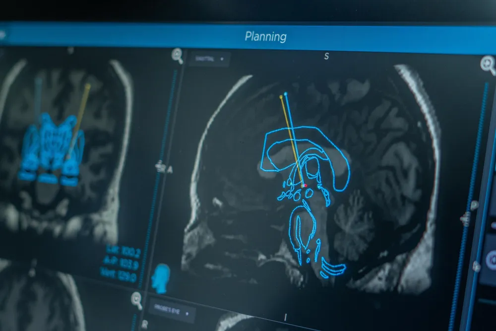 7fd6b2dc-2ef6-45d1-8b7f-cfa9abcb164d