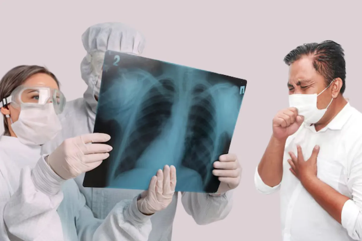 tuberculosis-reynosa-3655a0dd-focus-0-0-1200-600